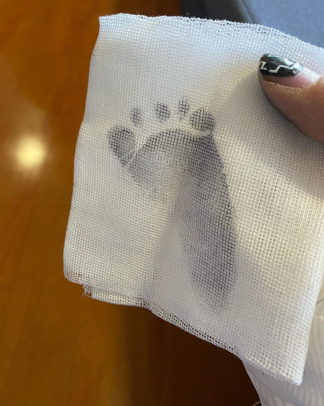 Además de las imágenes de él con la típica vestimenta de quirófano, azul, también publicó una fotografía de la tierna huellita del pie de su hijo en una gasa.