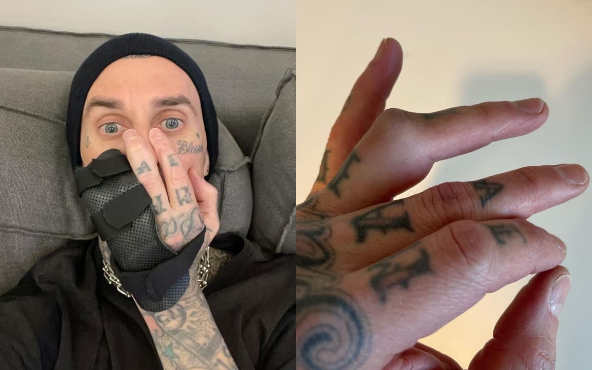 Travis Barker se somete a cirugía a días de arrancar la gira de Blink-182