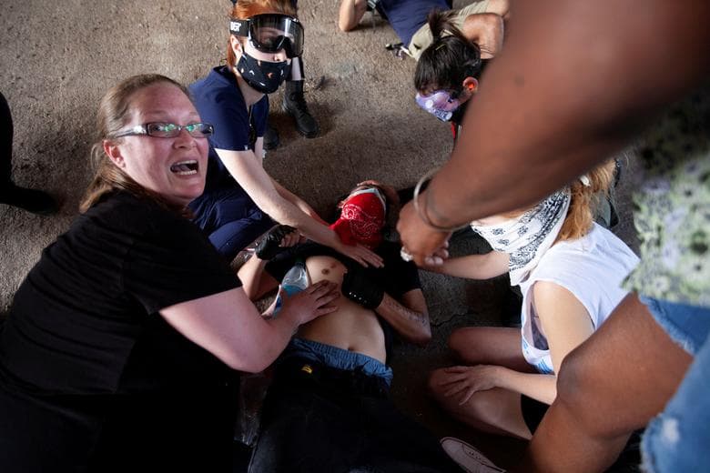 Austin, Estados Unidos.
<br>
<br>En los Estados Unidos, la policía utilizó balas de goma para intentar contener las protestas. Esto provocó que más de un civil saliera lesionado.