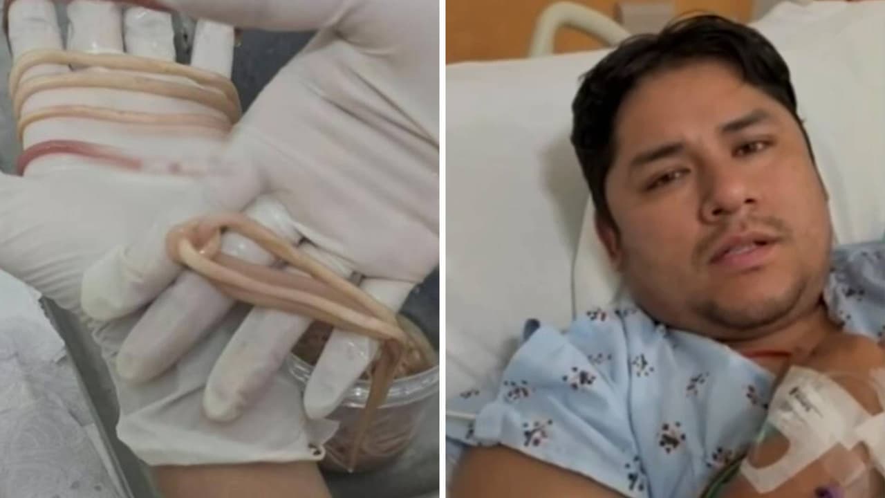 Niño tenía 142 lombrices intestinales e inmigrante pierde un brazo: lo más visto de Primer Impacto en la semana