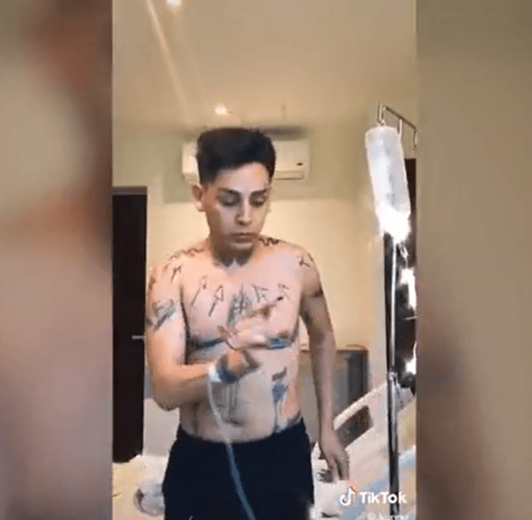 La estrella de TikTok quiso lucir más estilizado, por lo que asistió con profesionales para hacerse el procedimiento y fue compartiendo paso a paso el proceso.