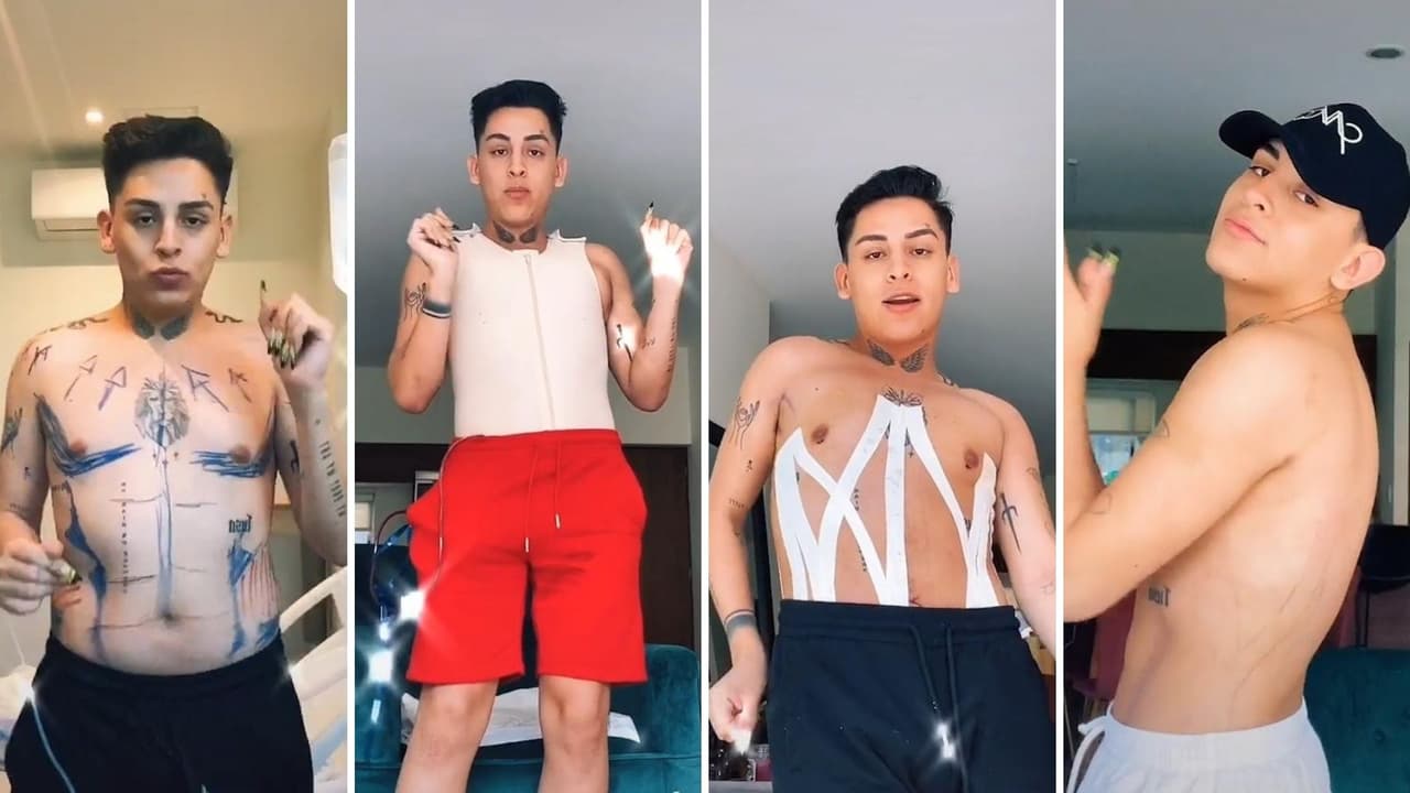 Desde su liposucción hasta su recuperación, así luce Papi Kunno tras cirugía estética (VIDEO)