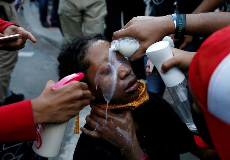 Por ello, durante las protestas, muchos asistentes cargaron con agua, jabón y algunos artículos para limpiar el gas lacrimógenos del rostro. El intenso dolor no se evita, pero al menos disminuye.
