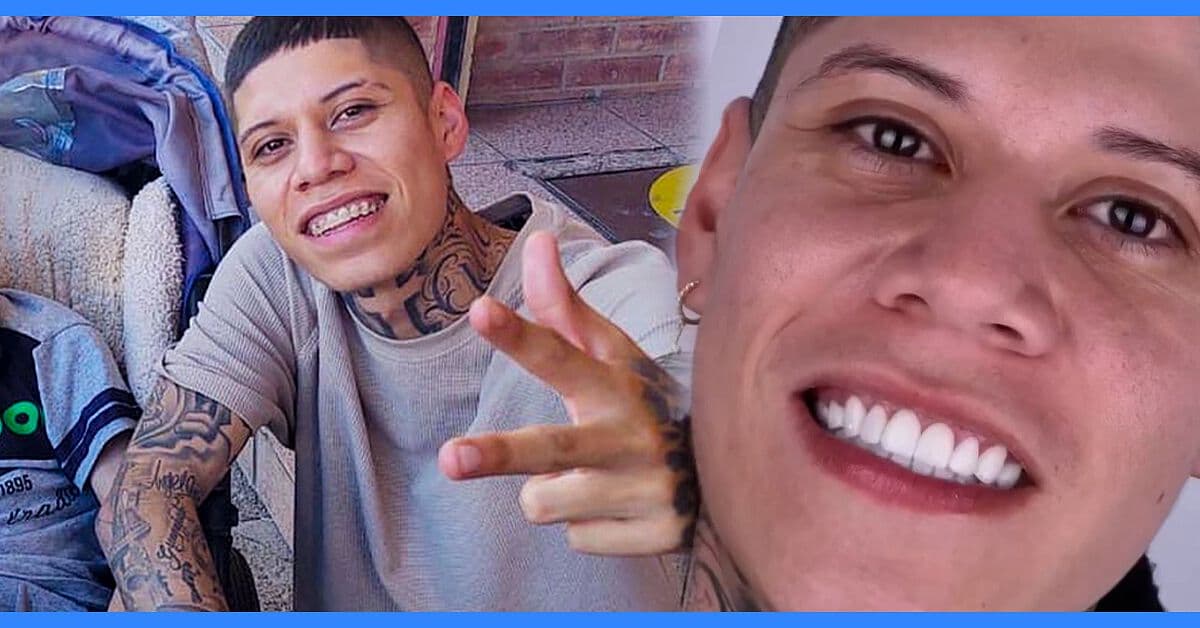 Santa Fe Klan cambia de look y sorprende al revelar su nueva sonrisa