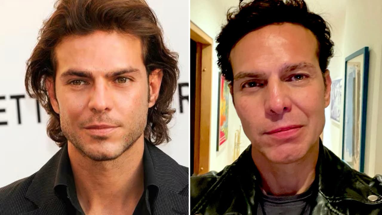 Protagonista de ‘Pasión de Gavilanes’ recibe crueles críticas por secuelas de condición que tuvo