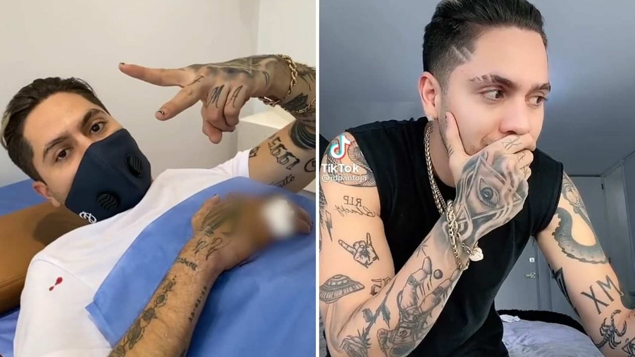 JD Pantoja muestra cómo le quedó la mano tras quitarse el yeso y los clavos