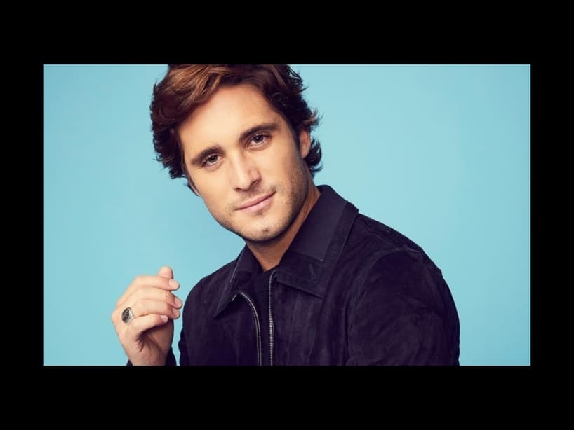 Para realizar el papel de "Luis Miguel", el actor se sometió a un procedimiento para separar sus diente; al terminar de grabar volvió a juntárselos.