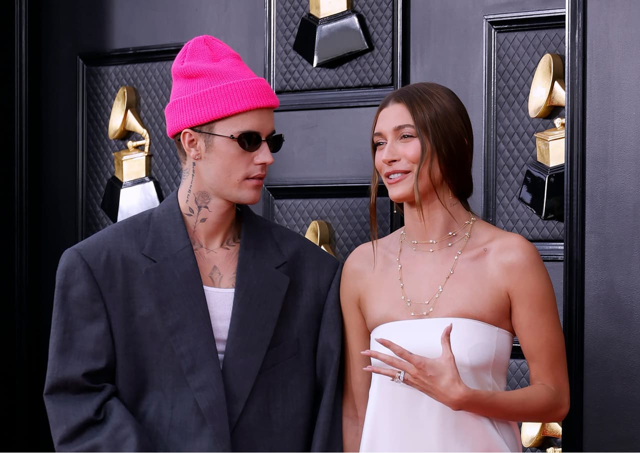 Hailey Bieber habla sobre cómo va Justin Bieber con su parálisis facial.