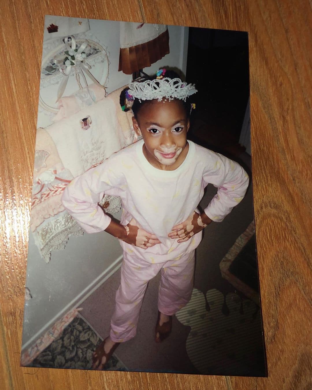 Su infancia fue muy difícil, porque por su imagen recibía gran cantidad de burlas e insultos por parte de otros niños, hasta que se tuvo que salir del colegio para ser educada en casa.